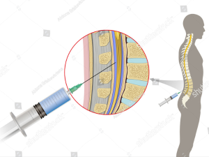 spinal needle